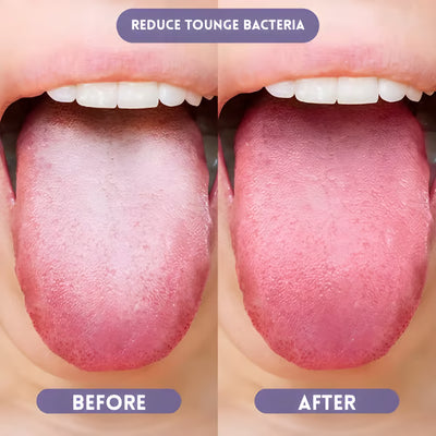 Probiotic Oral Spray